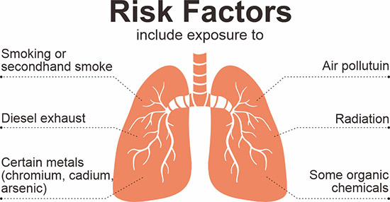 獲得肺癌的危險因素